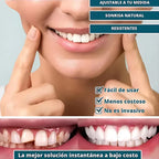 Sonrisa Perfecta™ | Carillas Dentales Ajustables de Resina + Estuche de Regalo - ¡Últimas unidades!