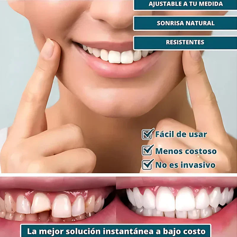 Sonrisa Perfecta™ | Carillas Dentales Ajustables de Resina + Estuche de Regalo - ¡Últimas unidades!