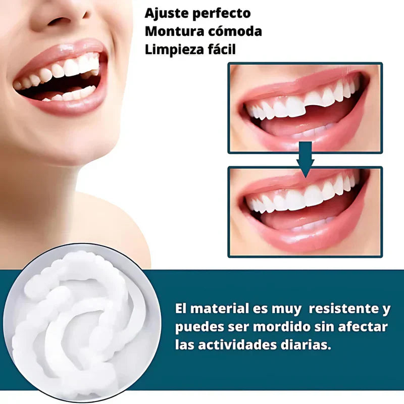 Sonrisa Perfecta™ | Carillas Dentales Ajustables de Resina + Estuche de Regalo - ¡Últimas unidades!
