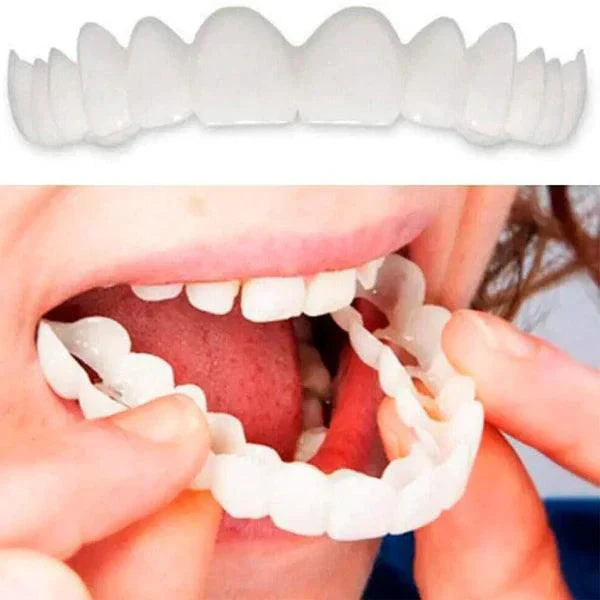 Sonrisa Perfecta™ | Carillas Dentales Ajustables de Resina + Estuche de Regalo - ¡Últimas unidades!
